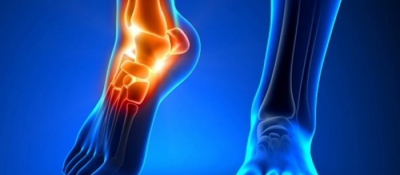 Ουρική αρθρίτιδα: Τι είναι & ποια ροφήματα επιδεινώνουν το πρόβλημα